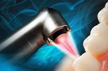 fotona lightwalker laser dentistry